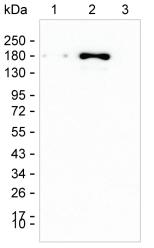 Clasp1